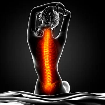 Back pain, artwork Stock Illustration
