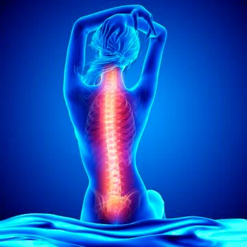Back pain, artwork Stock Illustration