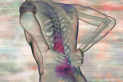 Back pain is a common condition and is particularly caused by sedentary Stock Illustration