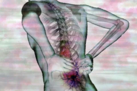 Back pain is a common condition and is particularly caused by sedentary Stock Illustration