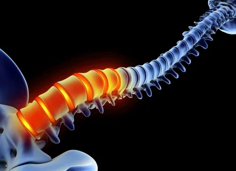 Back pain, computer artwork Stock Illustration