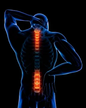 Back pain, conceptual artwork Stock Illustration