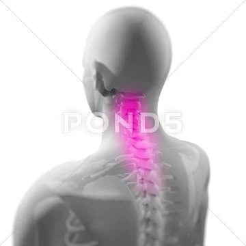 Back pain, conceptual artwork Stock Illustration