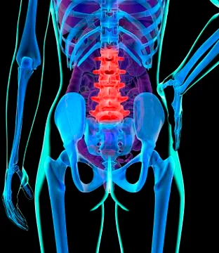 Back pain, conceptual artwork 스톡 일러스트