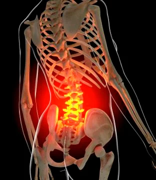 Back pain, conceptual artwork 스톡 일러스트