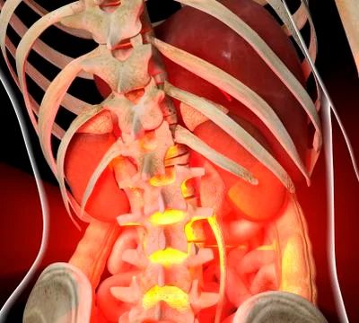 Back pain, conceptual artwork 스톡 일러스트