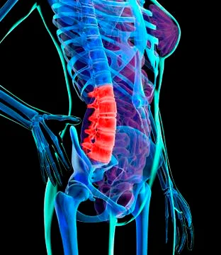 Back pain, conceptual artwork 스톡 일러스트