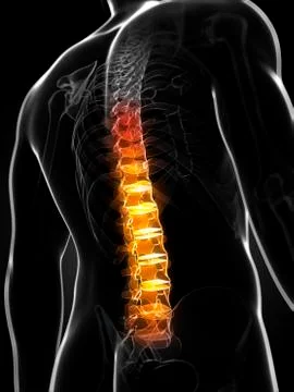 Back pain; conceptual artwork Stock Illustration
