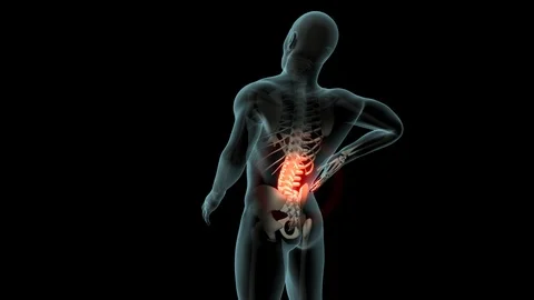 Back Pain 스톡 동영상 121791081