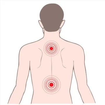 Back pain Stock Illustration