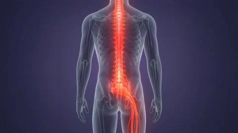 Back view of human spine with sciatic nerve inflammation highlighted in orang Stock Illustration