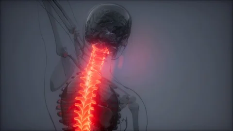 Backache in Back Bones 動画素材 113911045