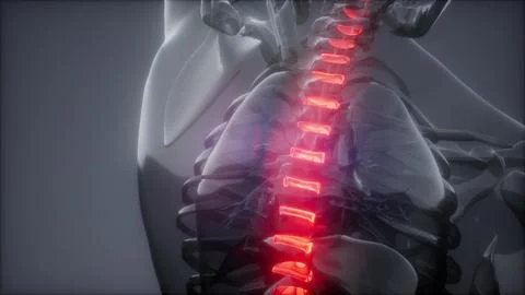 Backache in Back Bones Stock Illustration