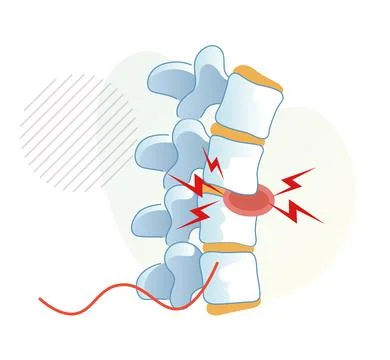 Backache - Stock Icon Stock Illustration