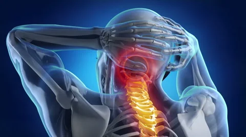 Backbone pain problem Stock Footage