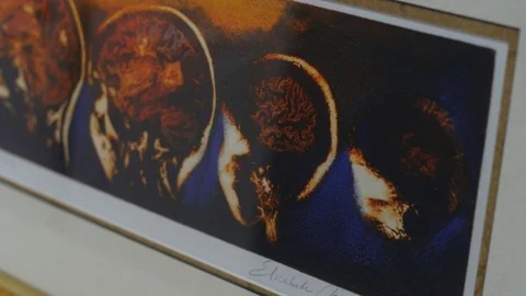 Background of brain scan images Stock Footage 103305014