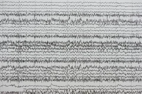 Background of brain waves on the paper Stock Photos