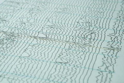 Background of electroencephalography or human brain waves Stock Photos