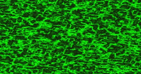 Background Infection Spreading Pulsating Disease Green Stock Footage 155508549