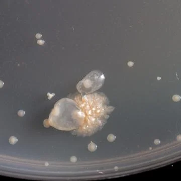 Bacteria on agar plate Stock-Fotos