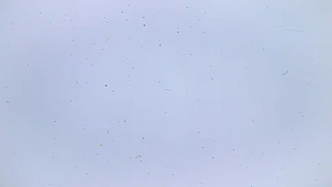 Bacteria and ciliate under Bright field Microscope 스톡 동영상 80360004