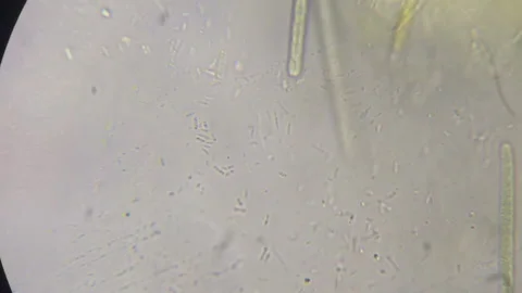 Bacteria and Cyanobacteria/Algae Movement Under Microscope - Realtime/True Color Stockbeeldmateriaal 148787000