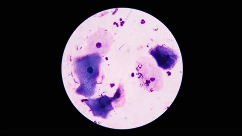 Bacteria cell in stop motion. Stock Footage 200442257