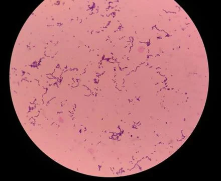 Bacteria cells finding with microscope. Stock Photos