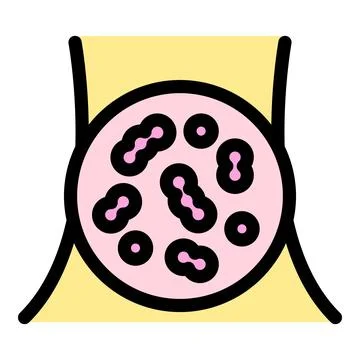 Bacteria colonizing human belly button creating infection イラスト素材