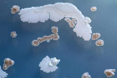 Bacteria contamination Photos