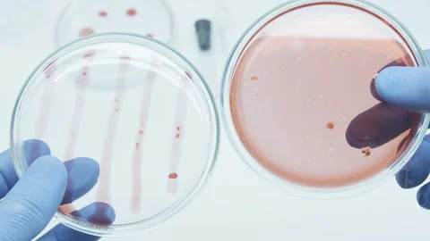 Bacteria culture Stock Footage 242806334