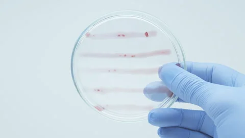 Bacteria culture Stock Footage 242806477