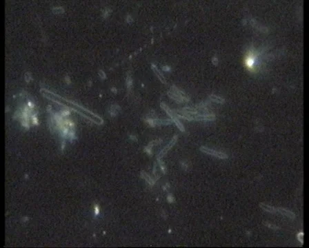 Bacteria DarkField-JPEG 75 PAL 스톡 동영상 5166023