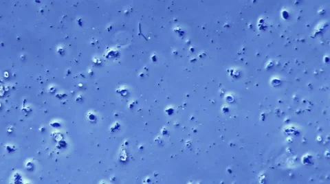 Bacteria Flagellum Sample In Microscope 800x Stock Footage 45892485