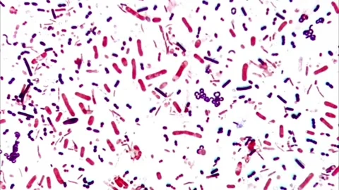 Bacteria gram stain under microscope, Stool sample 스톡 동영상 306577358