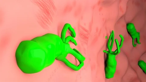 Bacteria inside stomach 3d animation Stock Footage 113672151