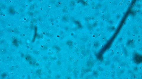 Bacteria from a microscope Video stock 10885596