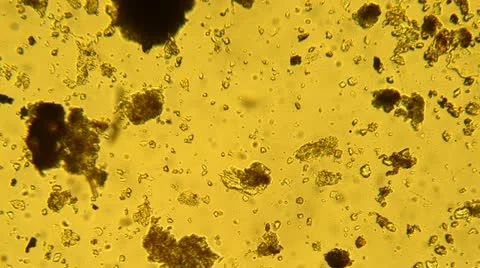 Bacteria from a microscope Stock Footage 10885663