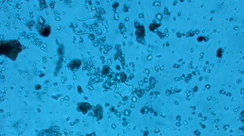 Bacteria from a microscope Stock Footage 10885750