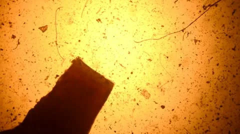 Bacteria from a microscope Stock Footage 10885781