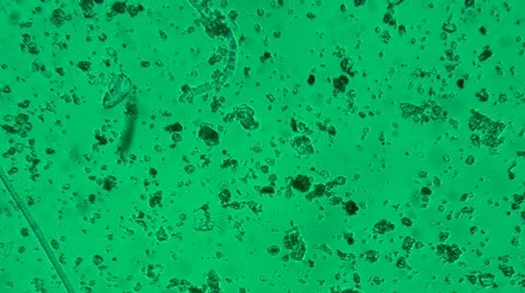 Bacteria from a microscope Stock Footage 10885934