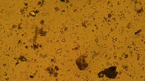 Bacteria from a microscope Vídeos de archivo 10886014