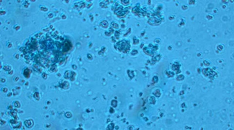 Bacteria from a microscope Stock Footage 10886416