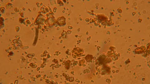 Bacteria from a microscope Stock Footage 10886485