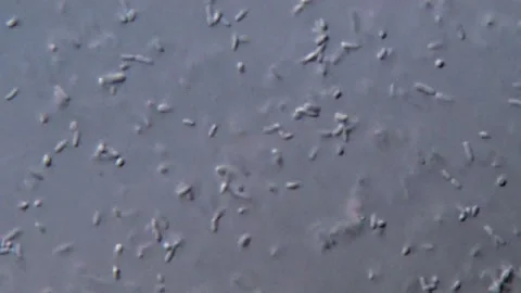 Bacteria motion, microscope view 400x Vidéo 317141142