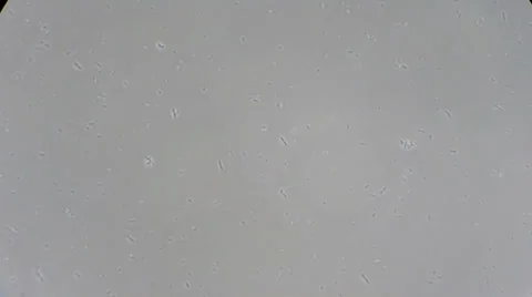 Bacteria movements under microscope Stockbeeldmateriaal 33661817