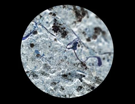 Bacteria or cells under a microscope. Multiplication of bacteria or infection Stock Photos