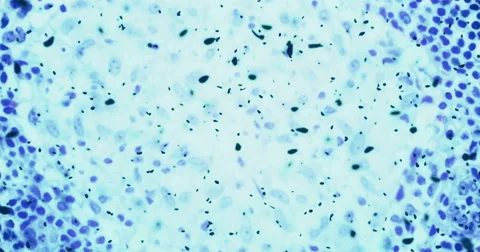 Bacteria or germs microorganism cells under microscope Видео 64755370