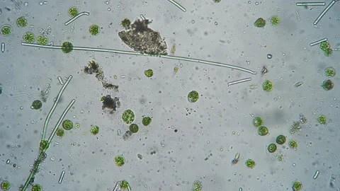 Bacteria or germs microorganism cells under microscope moving in color chemical Stock Footage 223024640