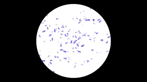 Bacteria or microbes under microscope Video stock 313655435